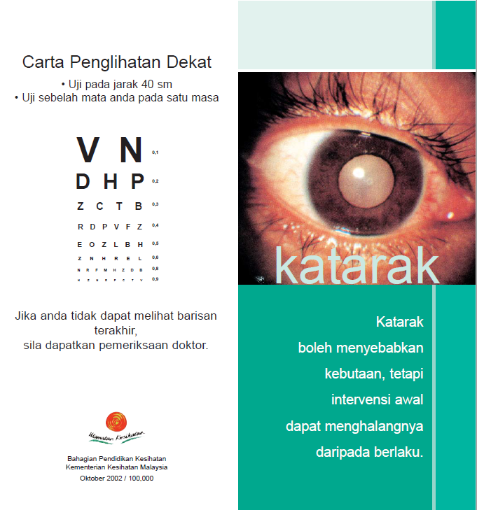 9_Katarak1